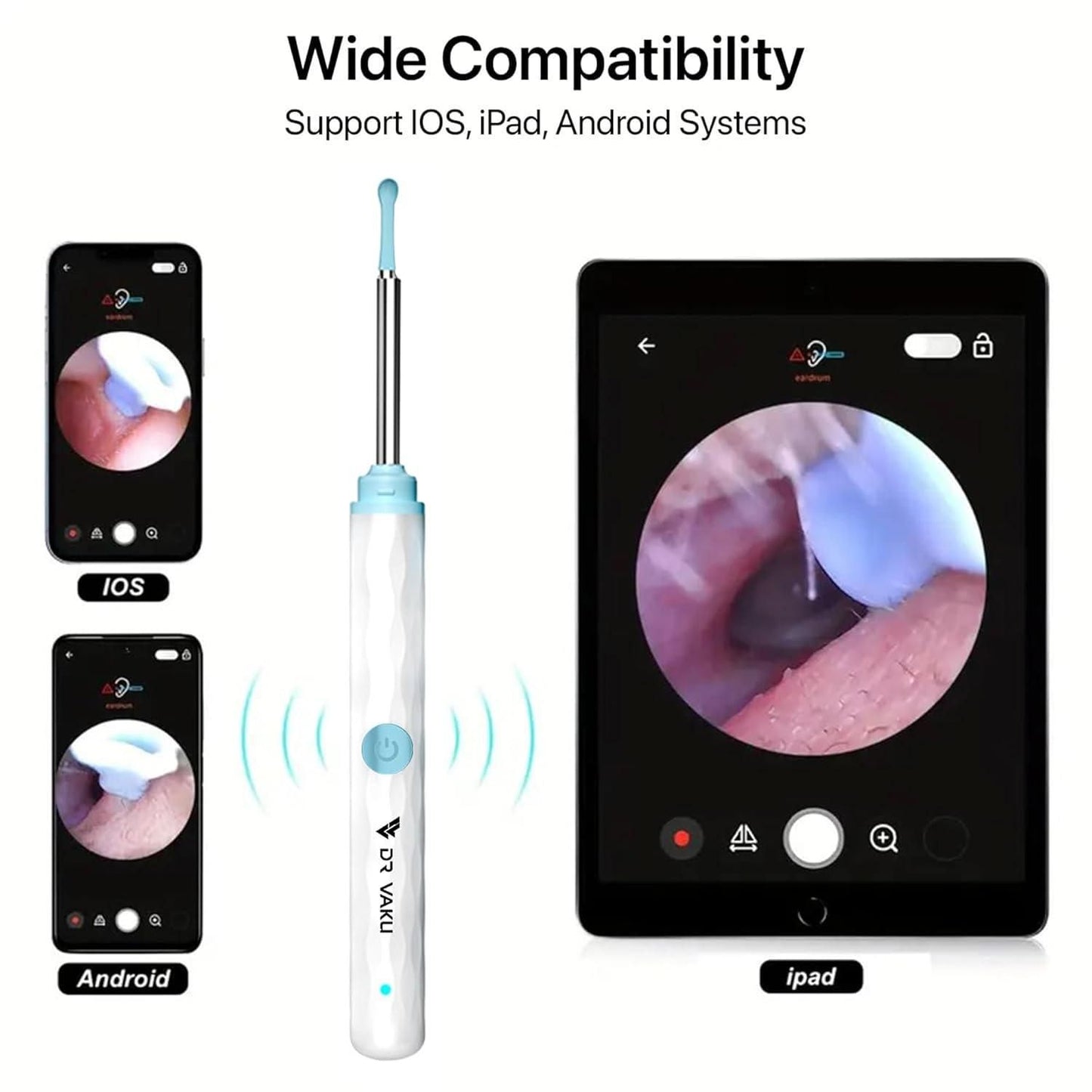 Smart Visual Ear Wax Cleaner - SKNCART