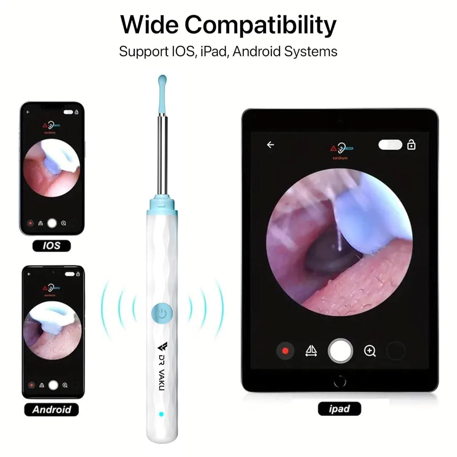 Smart Visual Ear Wax Cleaner - SKNCART
