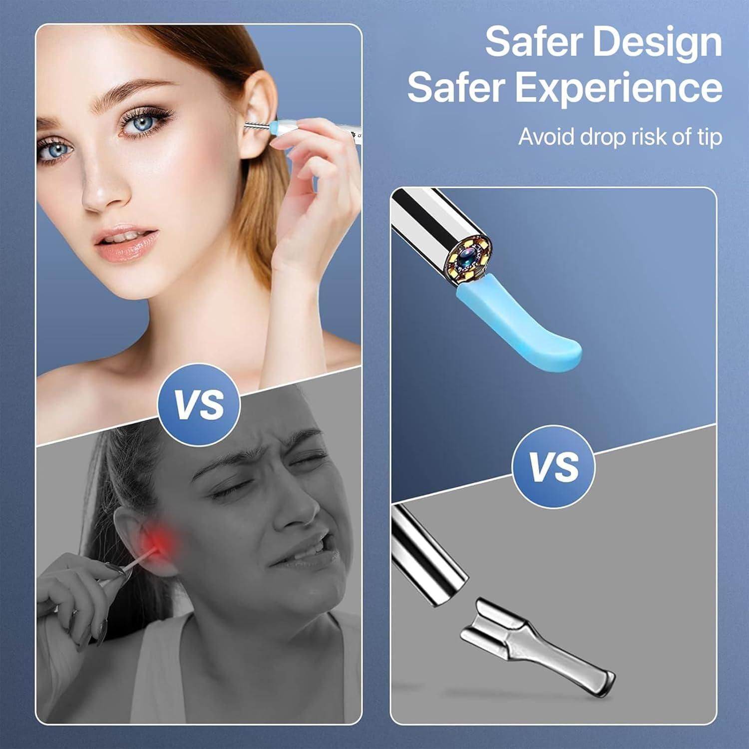 Smart Visual Ear Wax Cleaner - SKNCART